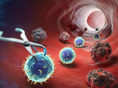 Neue In-vivo-Methode bringt CAR-T-Krebstherapie voran
